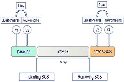 Alterations in local activity and functional connectivity in patients with postherpetic neuralgia after short-term spinal cord stimulation